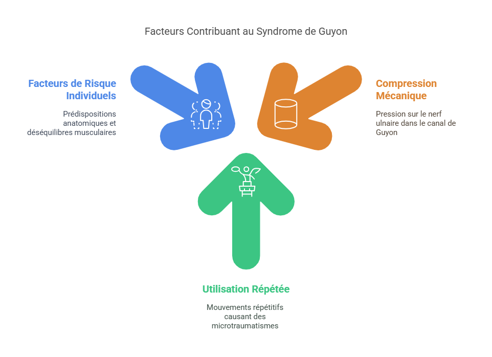 Syndrome de Guyon Blessures Sportives