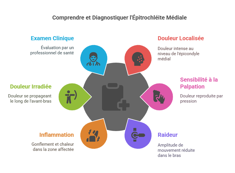 Épitrochléite Médiale (Golfer’s Elbow) Blessures Sportives